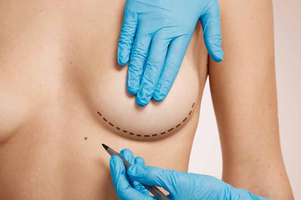 lipofilling